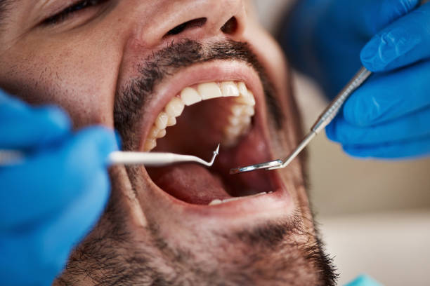 Best Oral Cancer Screening  in Lan, MI